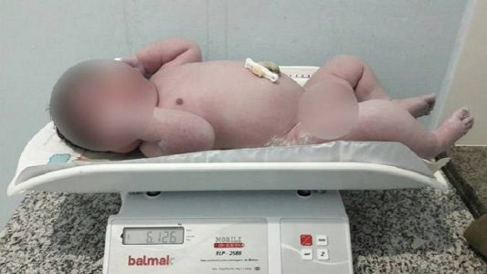 Bebe Nasce Com Mais De 6 Kg E Chama A Atencao De Medicos No Norte De Minas Gerais Blog Do Waldiney Passos